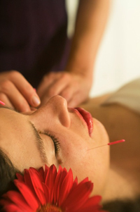 Santa Barbara Acupuncture