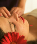 Acupuncture in Santa Barbara and  Montecito, CA