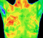 Santa Barbara Breast thermography