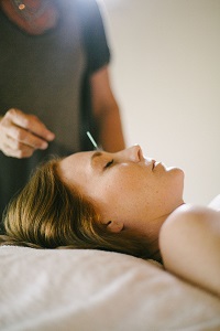 Santa Barbara Acupuncture
